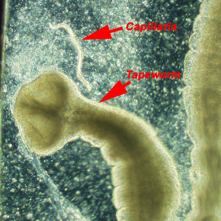 Tapeworm and Capillaria